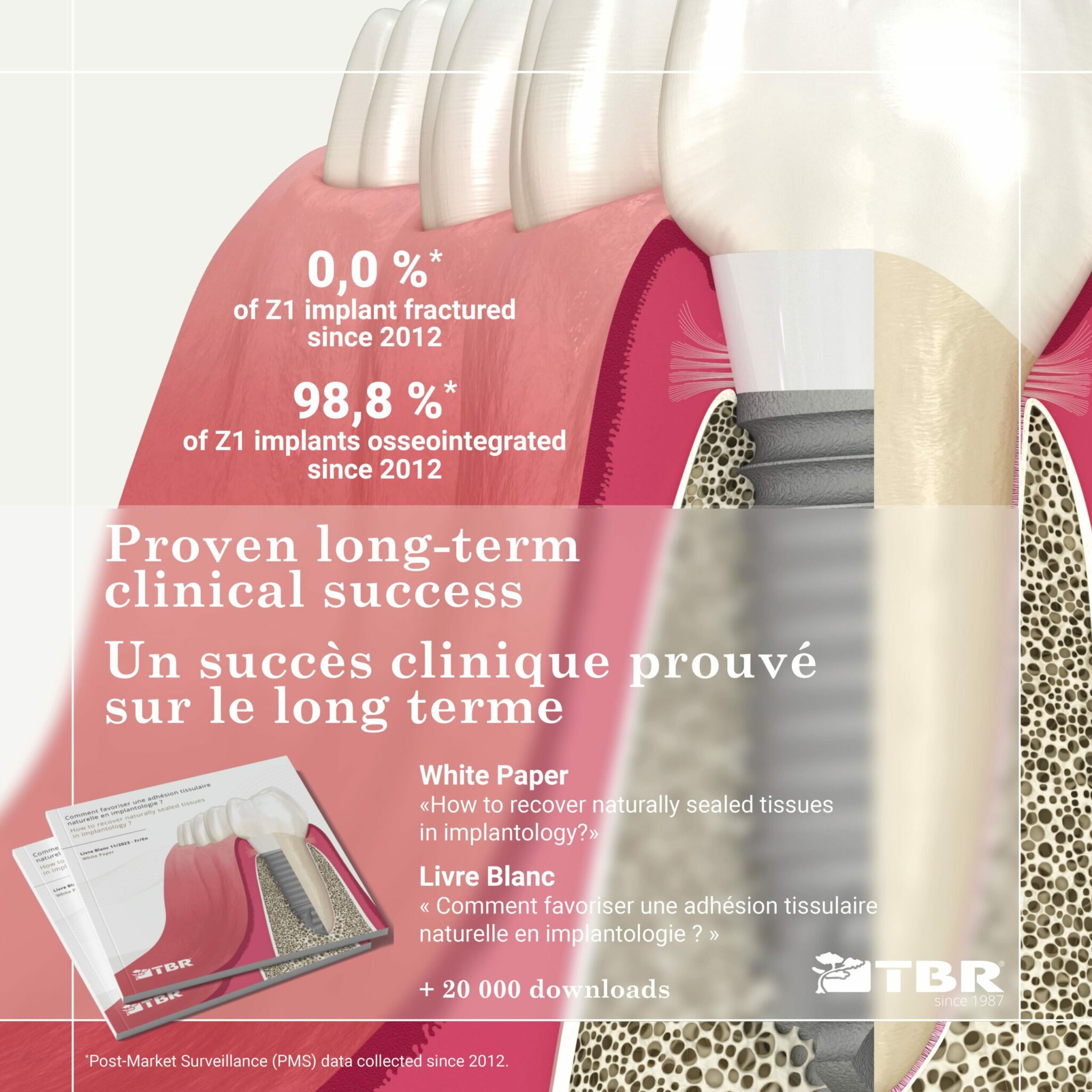 campagne-LBZ1-29102024-3-scaled.jpg